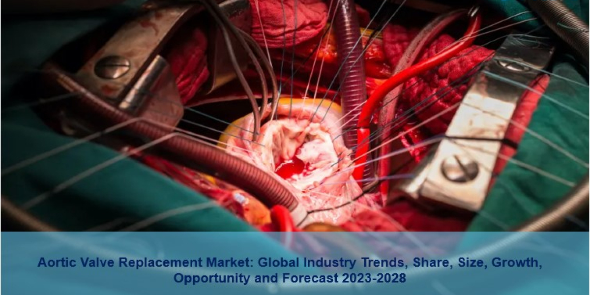 Aortic Valve Replacement Market 2023 | Size, Growth, Share, Trends And Forecast 2028