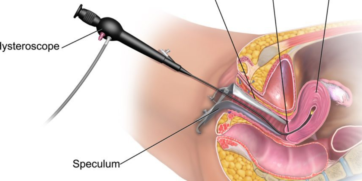 Hysteroscopes Market - Segment and Industry Growth by Forecast to 2030