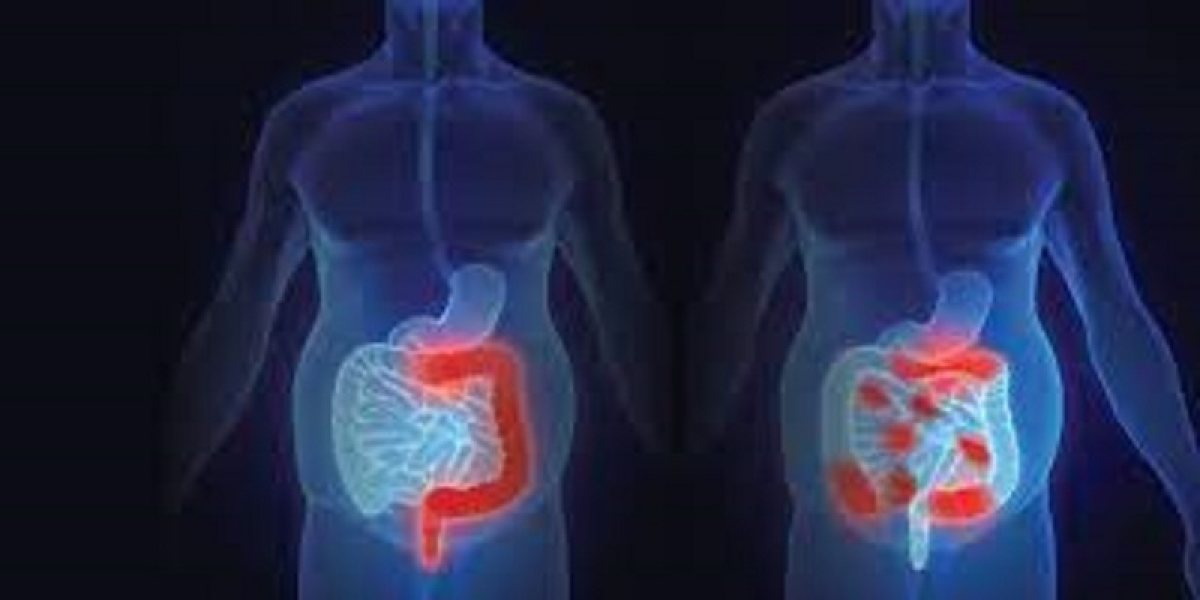 Crohn's Disease Market Research | 2023-2033