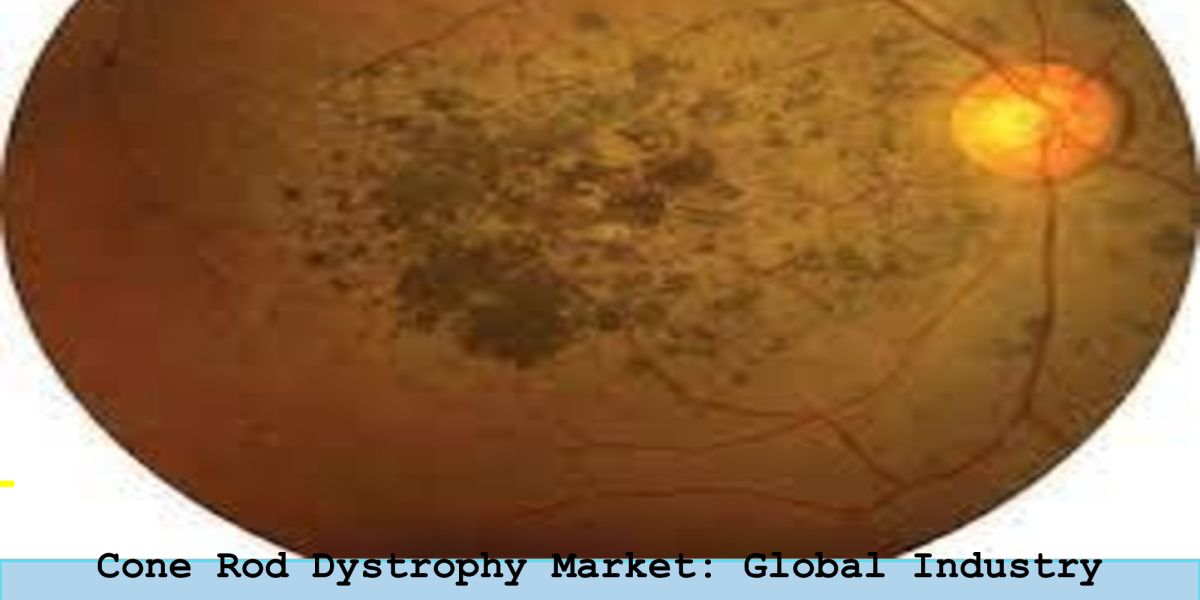Cone Rod Dystrophy Market Growth, Research Report and Forecast 2023-2033