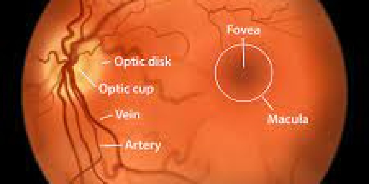 Macular Edema Market Size, 2023 Analysis, Industry Trends and Forecasts to 2033