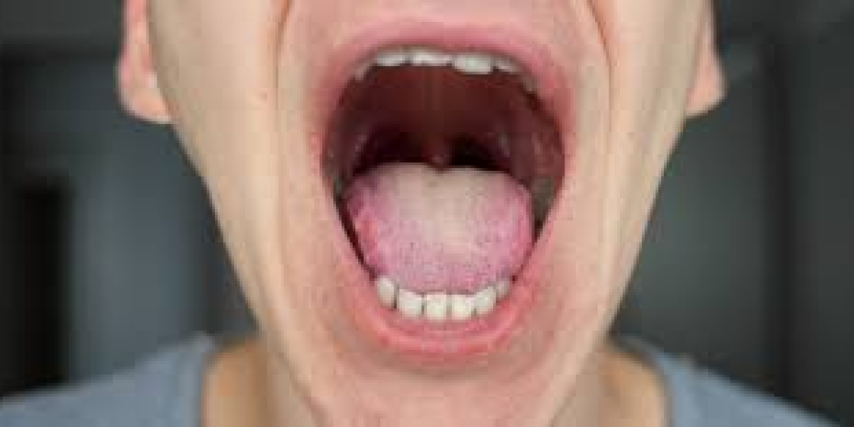 Mouth Neoplasms Market Size : Industry Trends, Opportunity And Forecast Till 2023-2033
