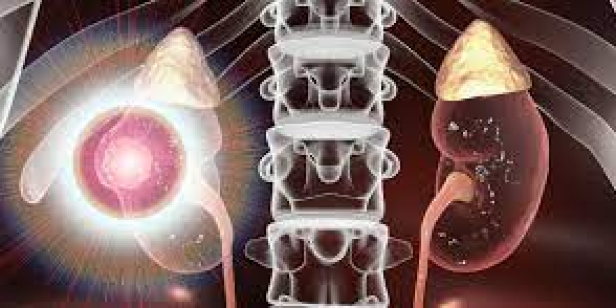 2023, Advanced Renal Cell Carcinoma Market | Industry Analysis Till 2033