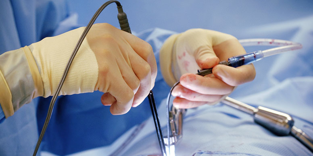 bariatric surgery devices market Size Worth 2.7  Billion by 2028| CAGR 5.4%