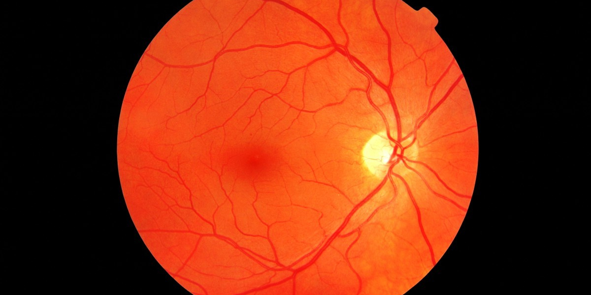 Diabetic Retinopathy Market is Estimated To Witness High Growth Owing To Increasing Prevalence of Diabetes and Technolog
