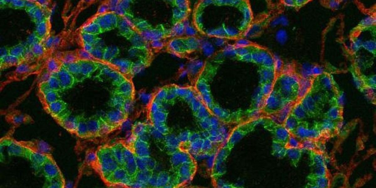 Extracellular Matrix Market is Estimated To Witness High Growth Owing To Increasing Prevalence of Chronic Diseases