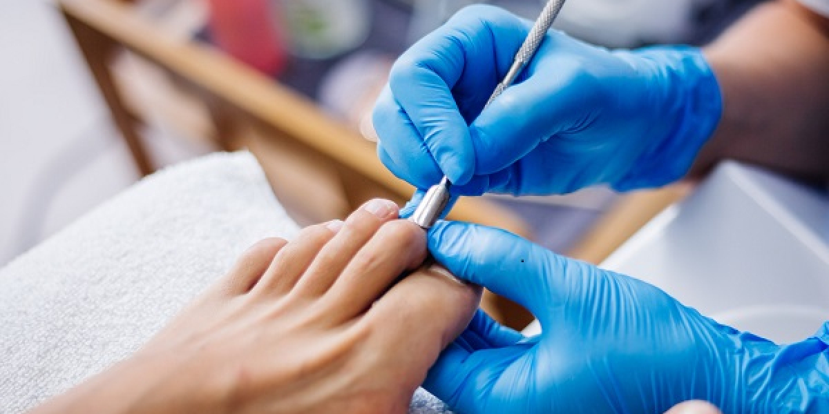 Dermatophytic Onychomycosis Treatment Market Set to Witness Y-o-Y Growth by 2032