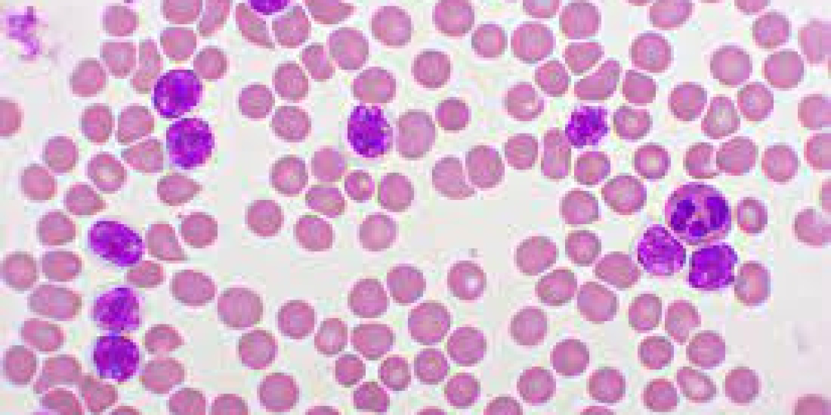 Chronic Lymphocytic Leukemia Market Size, Growth, Analysis & Industry Trends 2023-2033