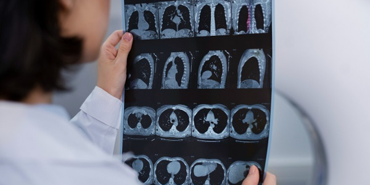 Medical Imaging Market Assessment, Key Factors and Challenges by 2032