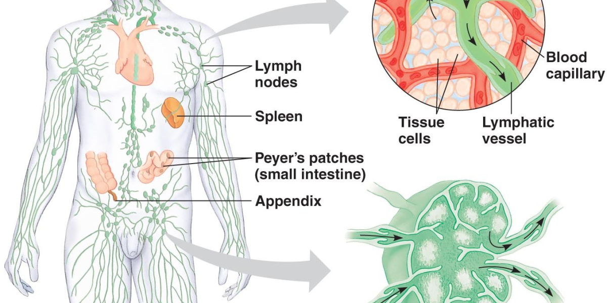 Advancements in Diagnostic Tools for Accurate Lymphoma Detection