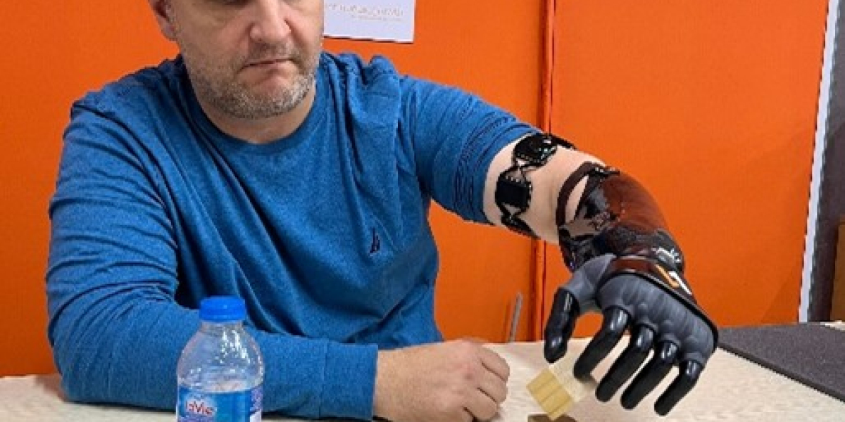 A robotic prosthetic arm