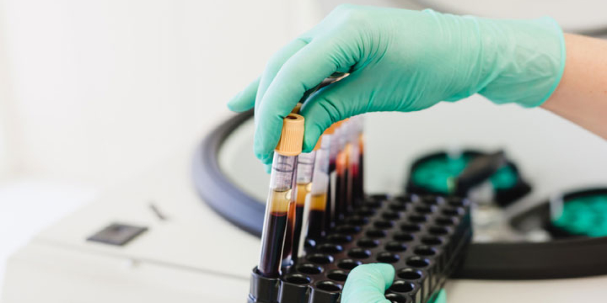 Plasma Fractionation Market Size, Share, Industry Growth, Report 2023-2028