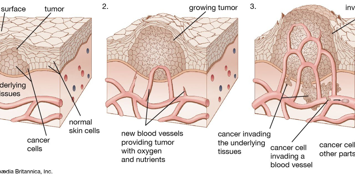 Targeted Therapies for Skin Cancer: FDA-EMA Approved Drugs