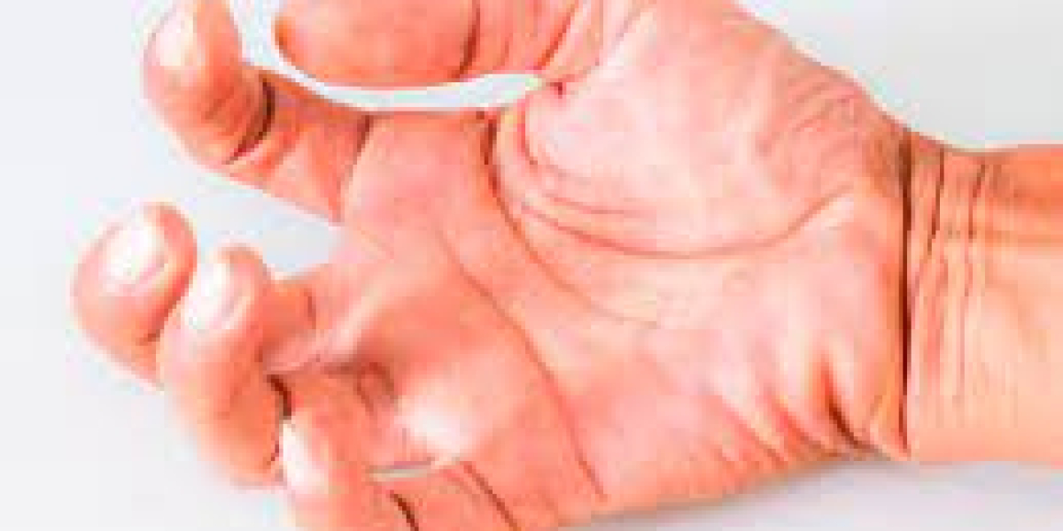 Muscle Spasticity Market Epidemiology, Overview, Research Report & Trends 2023-2033