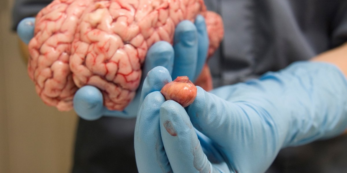 Barriers to Entry: Challenges in the Solid Tumor Disease Market