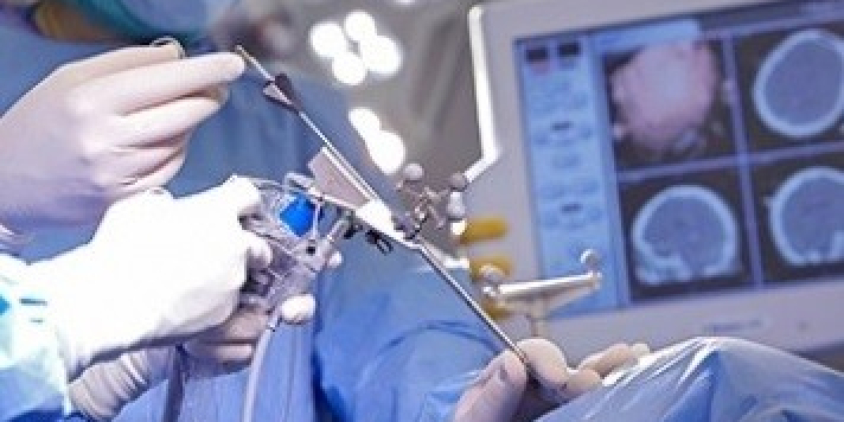 Neuroendoscopy Devices Market 2023 Rising Trends, Demand And Global Opportunity