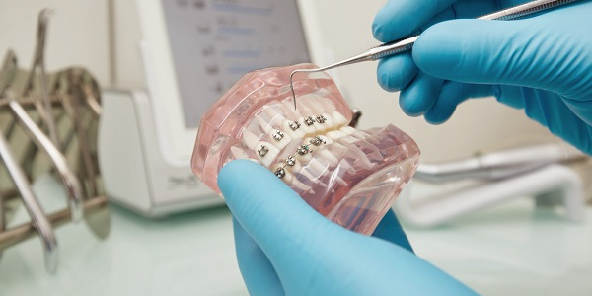 Dental Biomaterial Market Latest News and Pricing Strategy till 2032