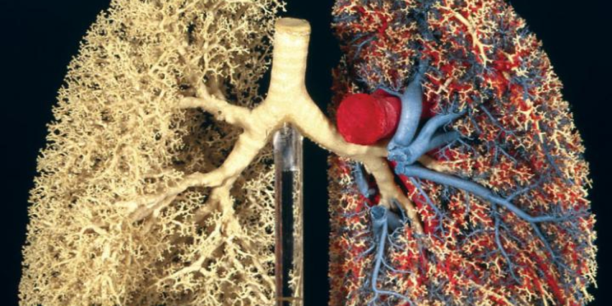 Cystic Fibrosis (CF) Disease Community Support: Finding Strength in Numbers