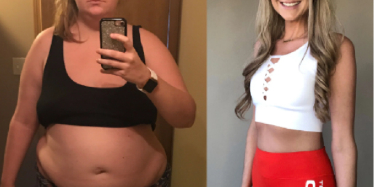 Total Fit Keto ACV Gummies Amazon & Get The Best Price?