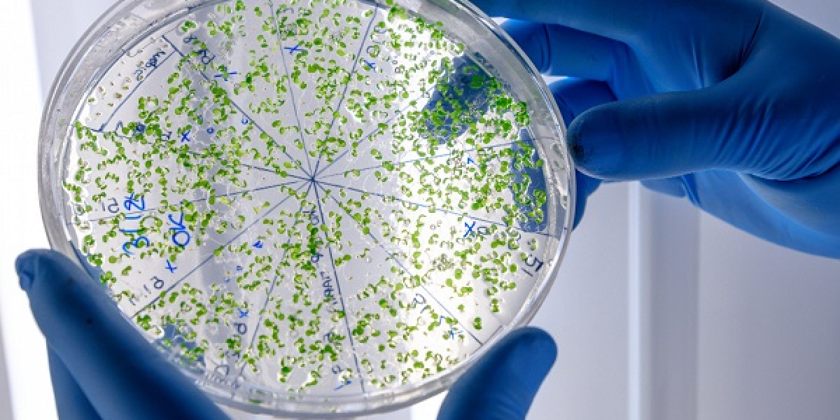 Mycoplasma Testing Market Future Demand and Forecast 2032