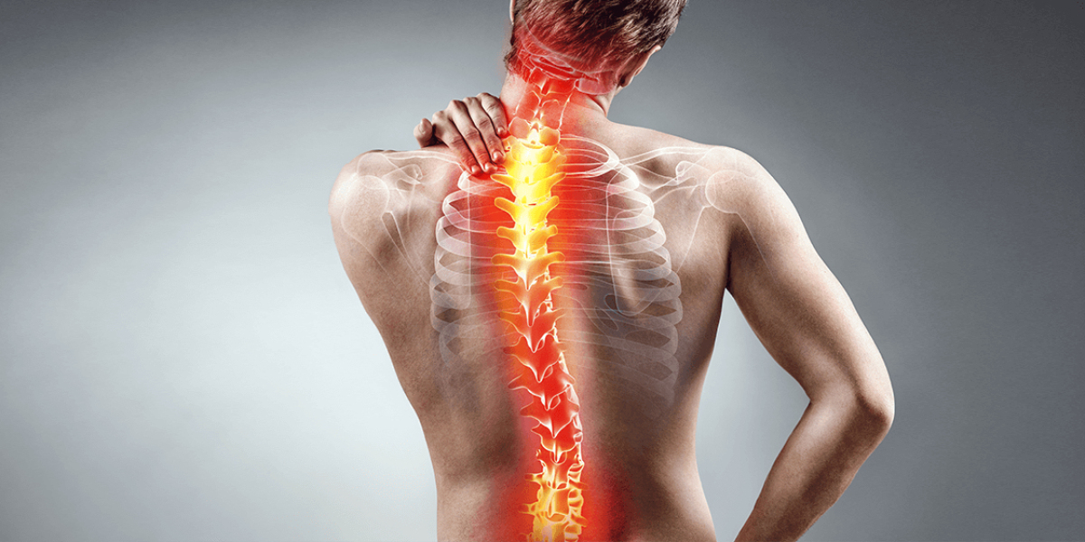 Physiotherapy for scoliosis treatment