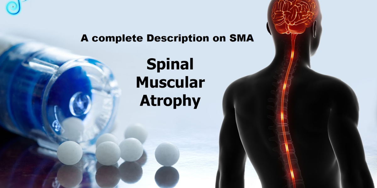 Spinal Muscular Atrophy (SMA) Disease Research and Clinical Trials: Progress and Promising Developments