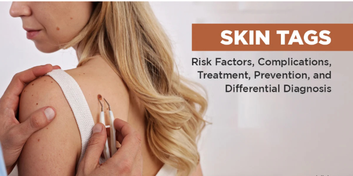 Skinbiotix MD Reviews Official Website Legit Or Hoax?