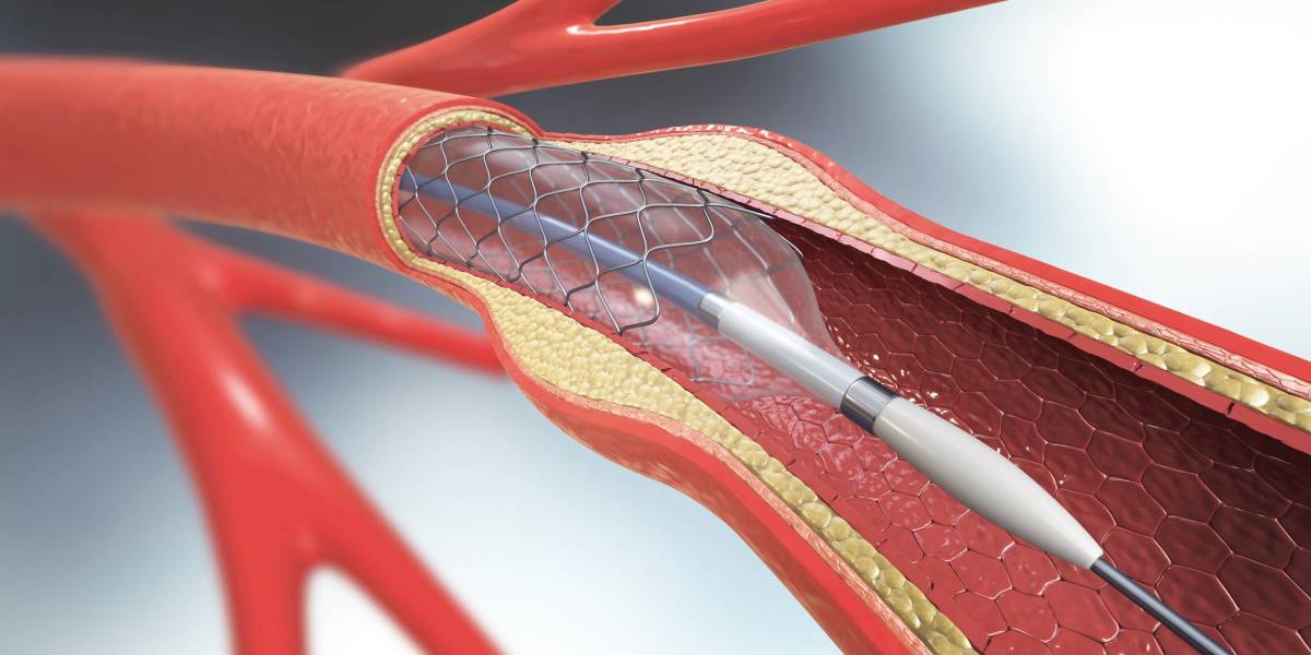 Thrombectomy Devices Market Research Growth Report Forecast to 2027