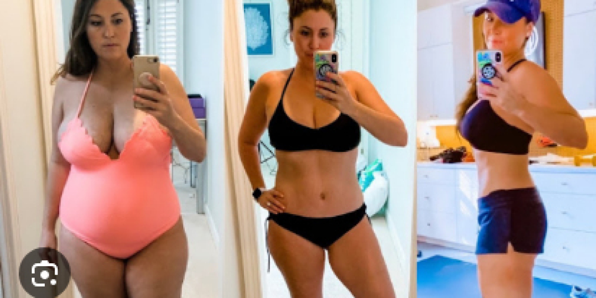 Keto Ripped ACV Gummies Results, Side Effects & Consumer Feedback!