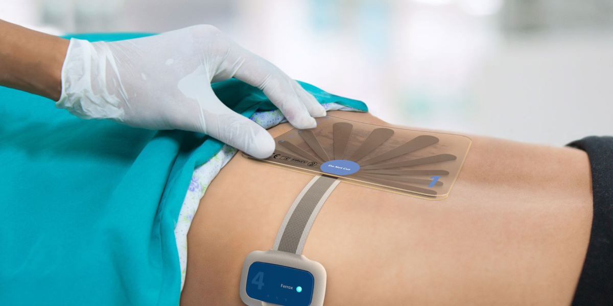 India Advanced Wound Care Management Market Is Estimated To Witness Strong Growth