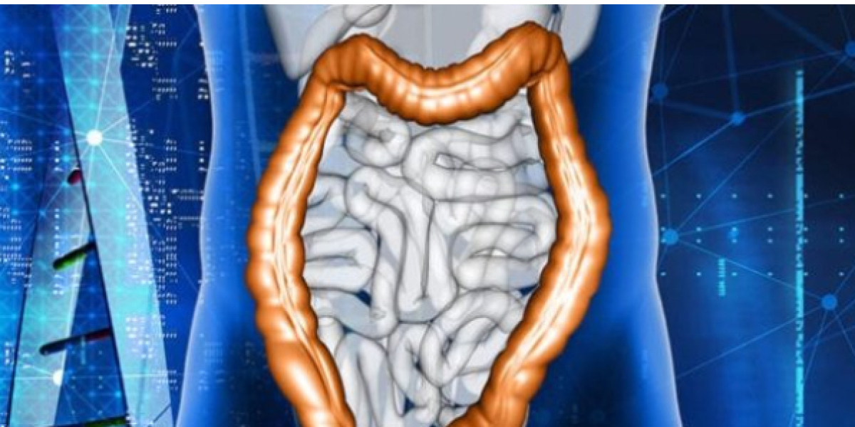 Guide on Gastroesophageal Reflux Disease (GERD)