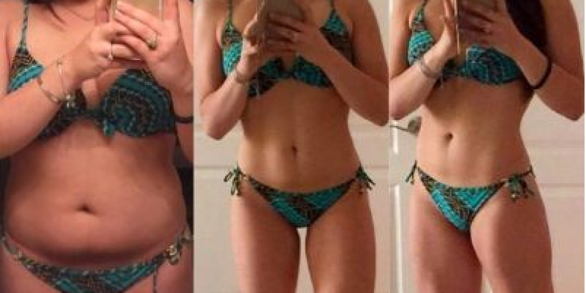 Pfizer Weight Loss Gummies Reviews - URGENT Customer Warning! Honest Truth Exposed (2023 Update)