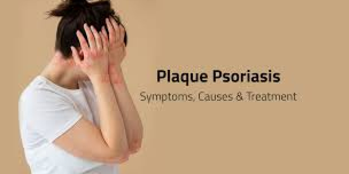 Plaque Psoriasis: A Comprehensive Guide