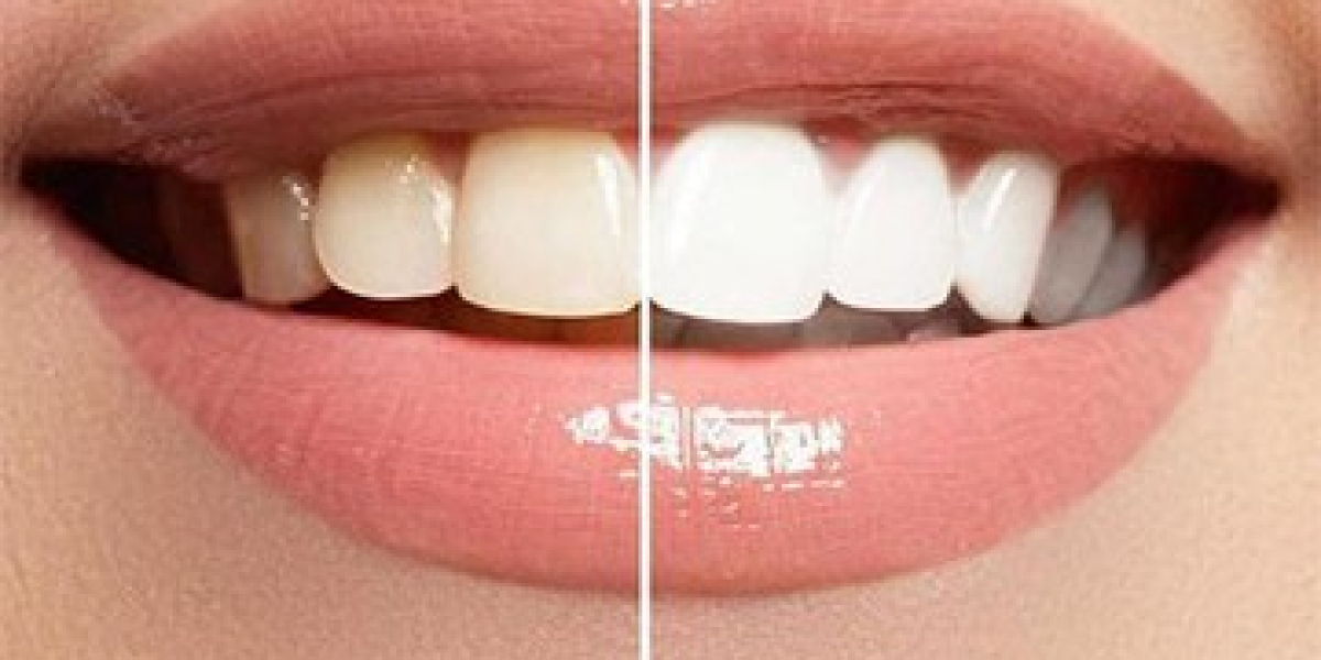 https://www.facebook.com/TheProDentimAustralia/