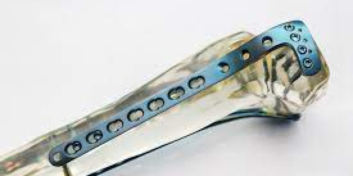 Orthopedic Implants Market 2023 Development Status, Top-Vendors, Type and Application by 2032