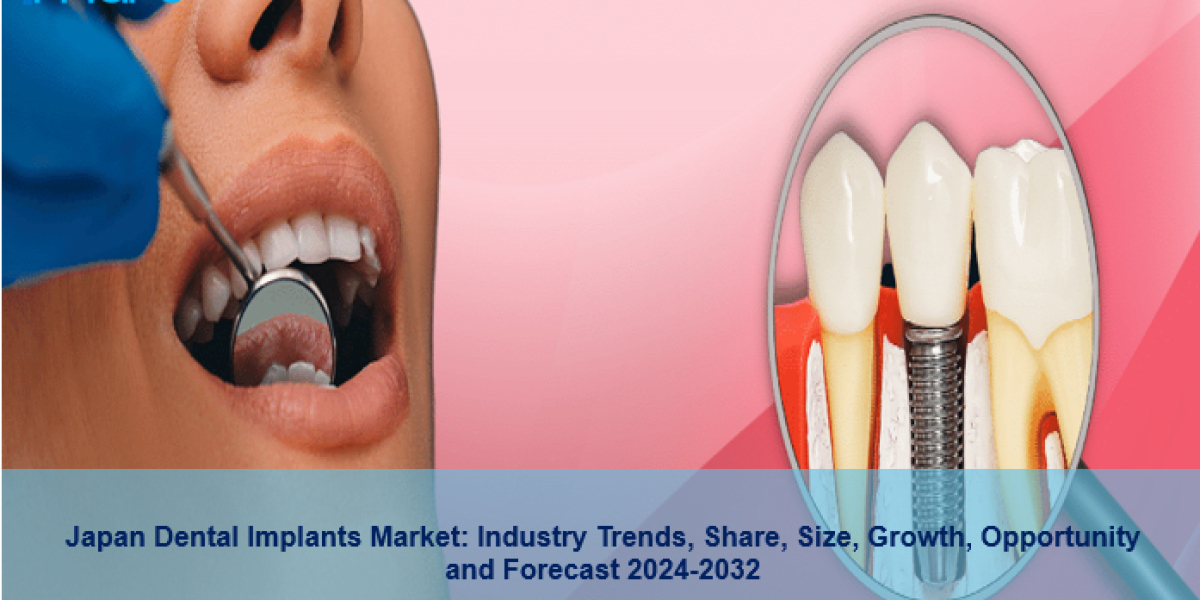 Japan Dental Implants Market Growth, Trends And Forecast 2024-2032