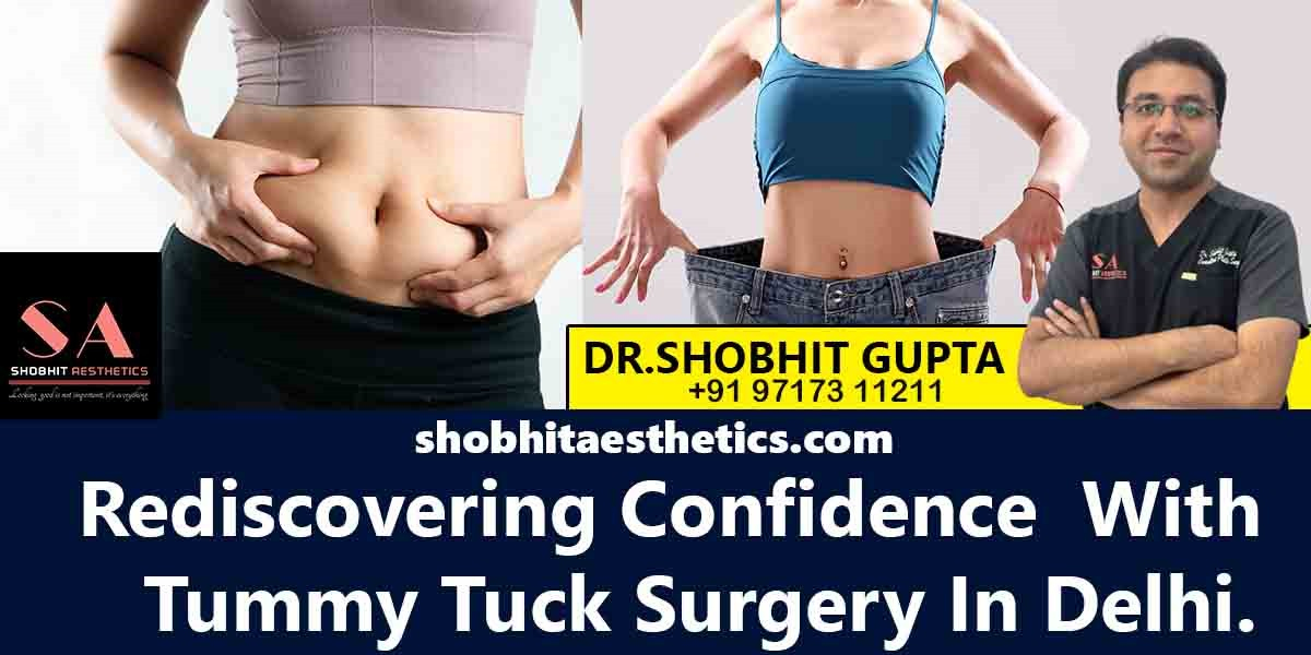 Rediscover Confidence, Tummy Tuck in Delhi at Shobhit Aesthetics