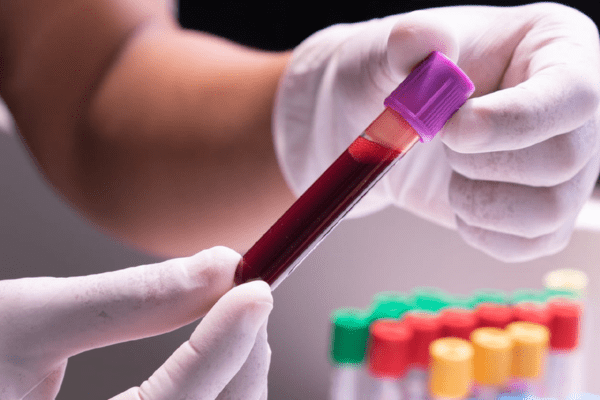 Blood Test Centre PCMC Pune-Pearl Diagnostics
