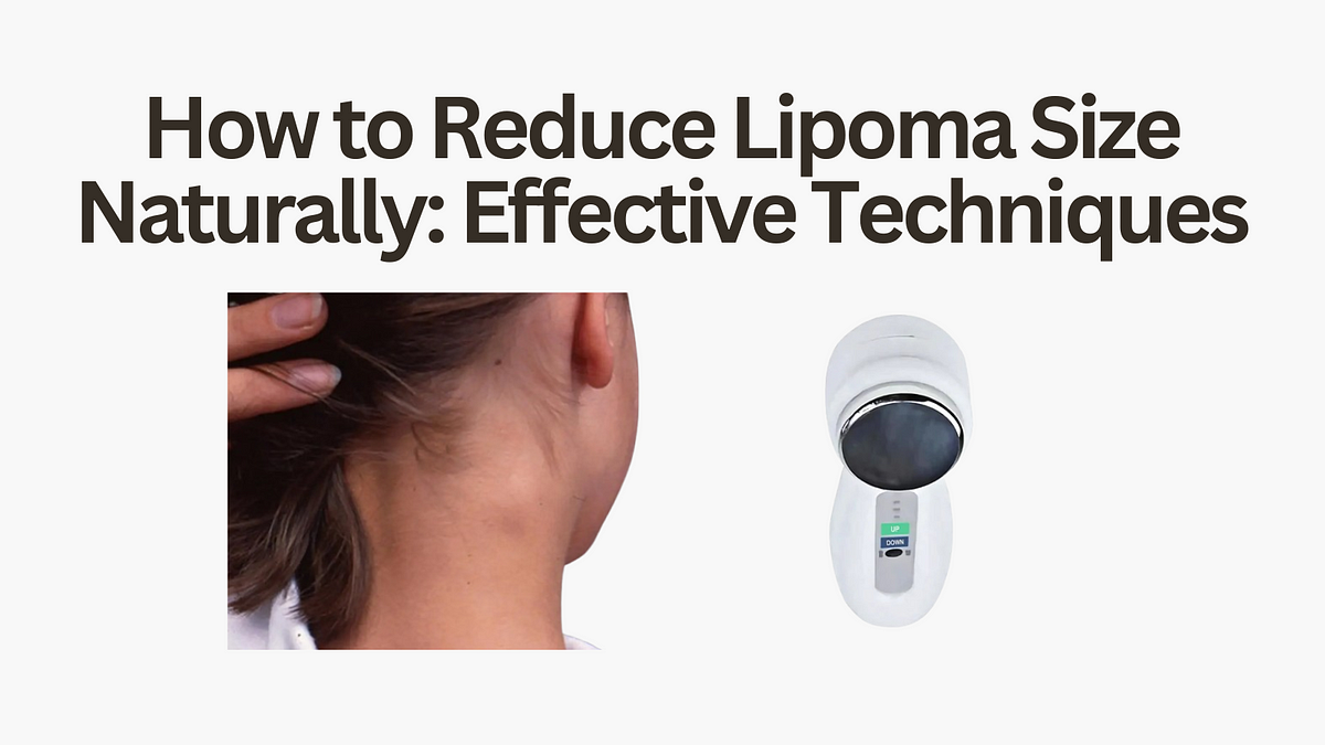 How to Reduce Lipoma Size Naturally: Effective Techniques | by James Coleman | Jun, 2025 | Medium