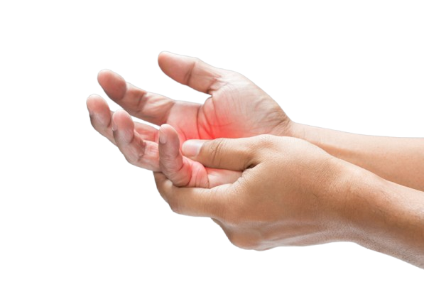 Dupuytren’s Contracture: Exploring New Treatment Options for Palmar Fibromatosis | by Dupuytren’s Wand | Medium