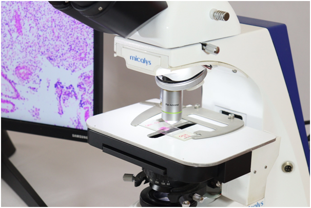 What is Automated Microscopes and its Potential in Decentralizing Pathology? - Medprime
