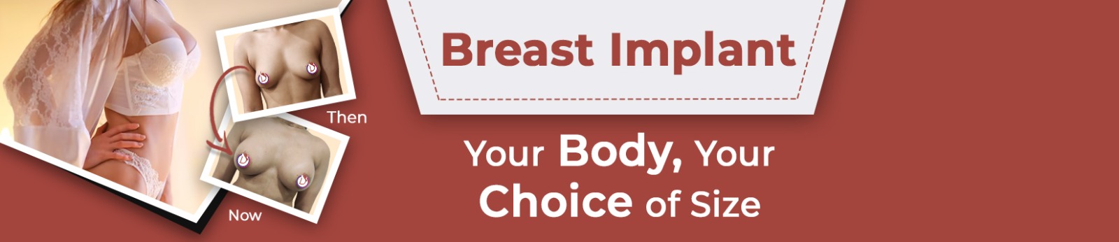 Affordable Breast Implant Surgery Cost in Gurgaon