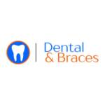 Dental And Braces