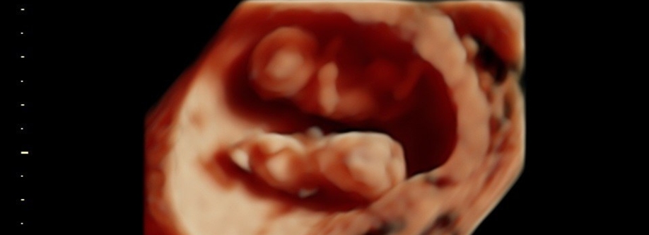 4d baby scan