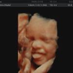 4d baby scan