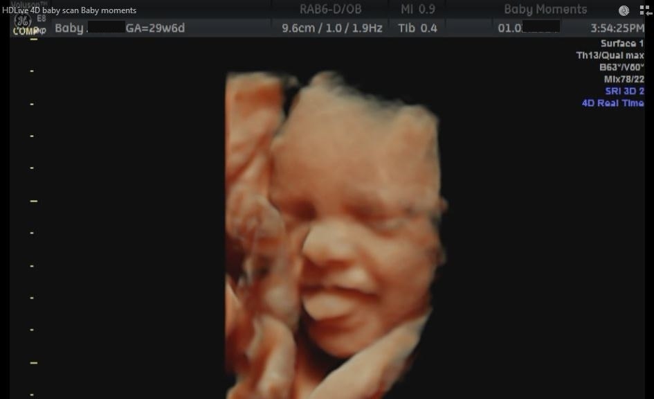 4d baby scan