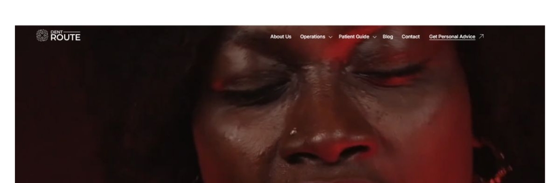 Dental Veneers in Turkey