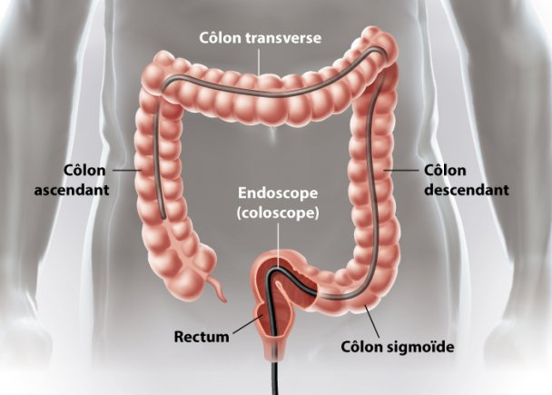 Coloscopie Virtuelle Privée | Clinique Spécialisée À Montréal