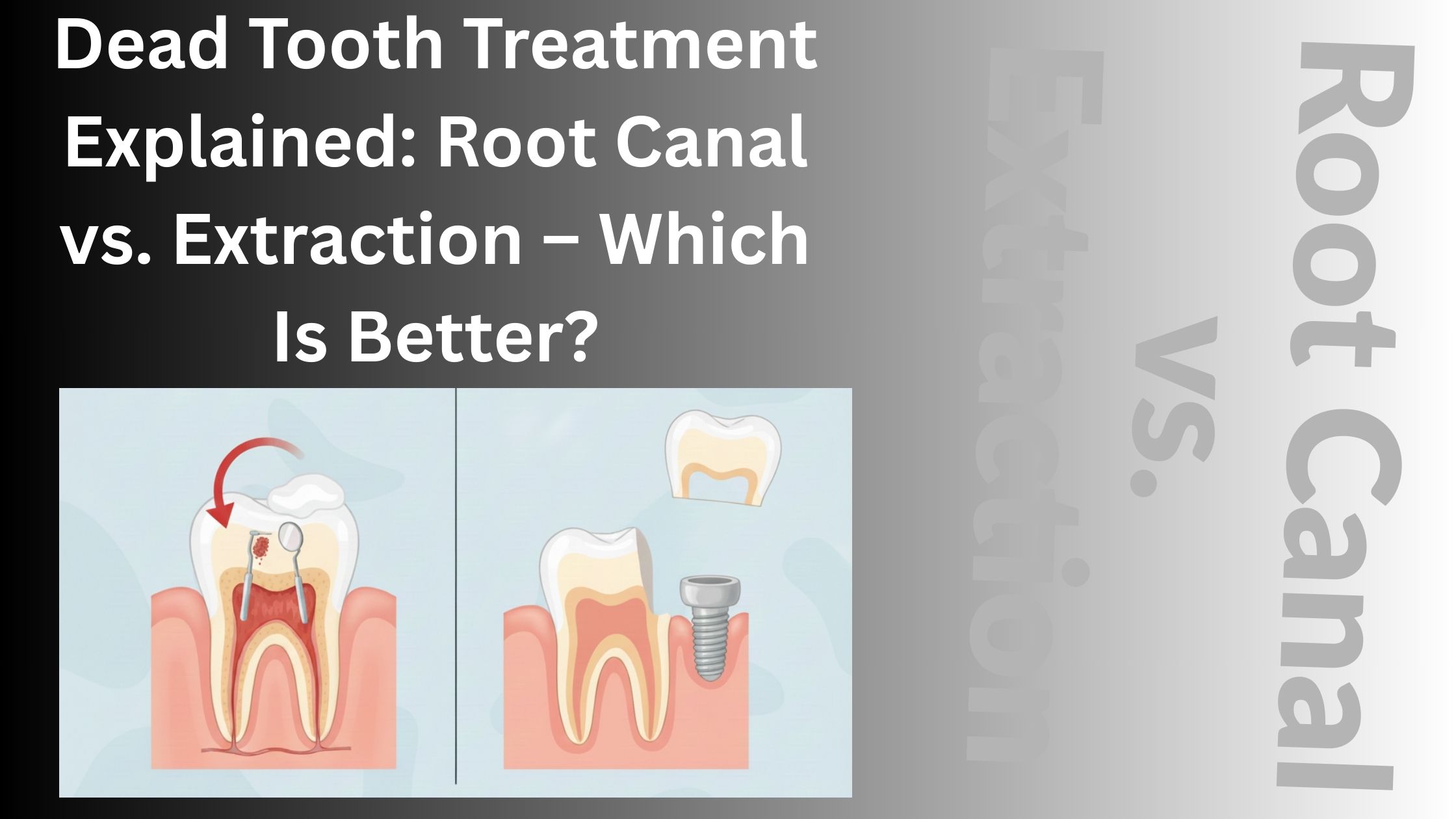 Dead Tooth Treatment Explained: Root Canal vs. Extraction – Which Is Better? – Carrum Downs Dental Group