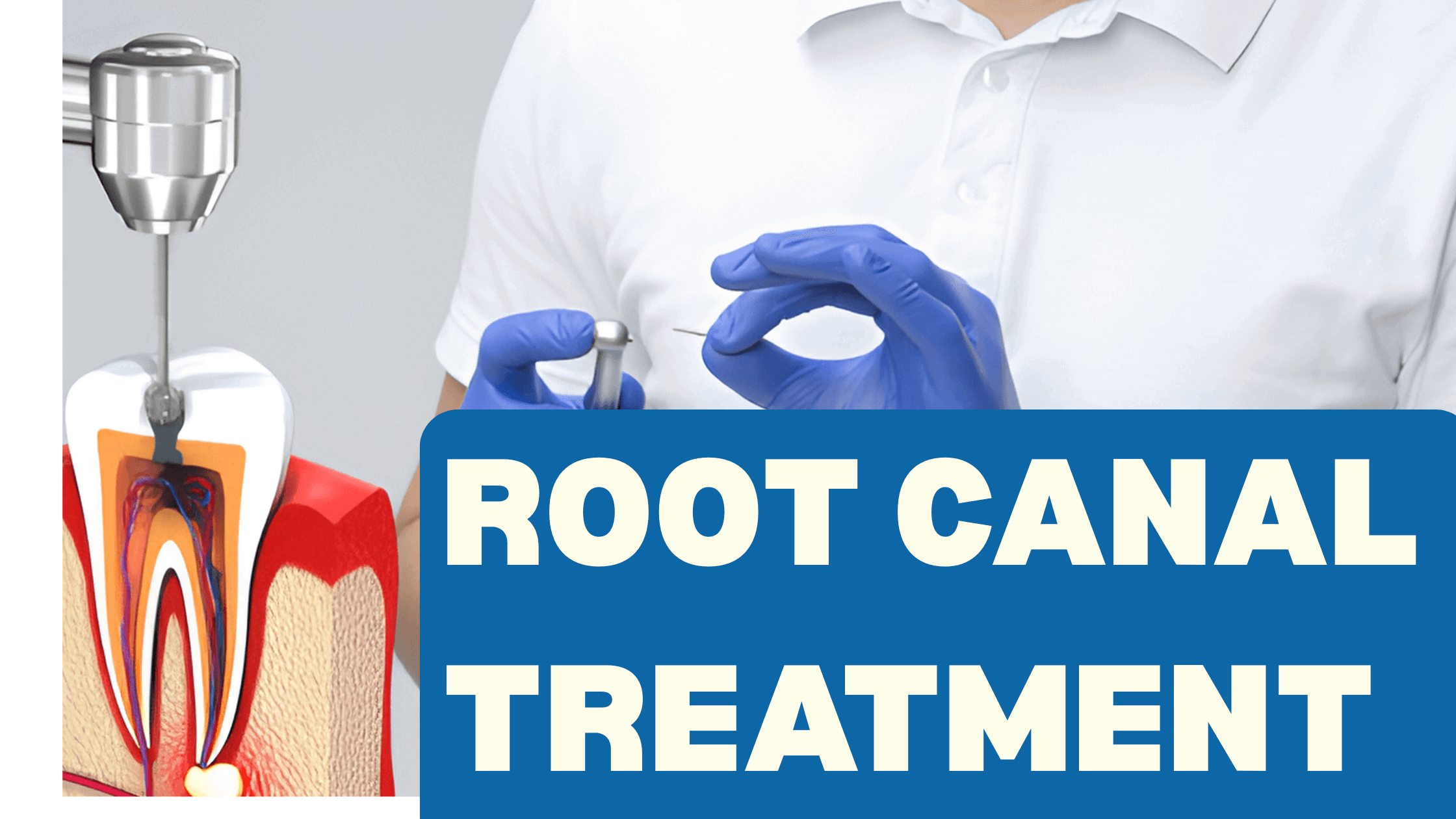Painless Root Canal Treatment in Jaipur | Manglam Dental Hospital